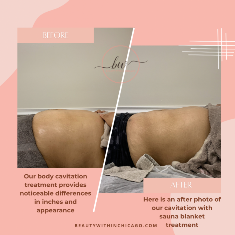 8219F535 1299 4C0F A79D F71FD04EAECB 768x768