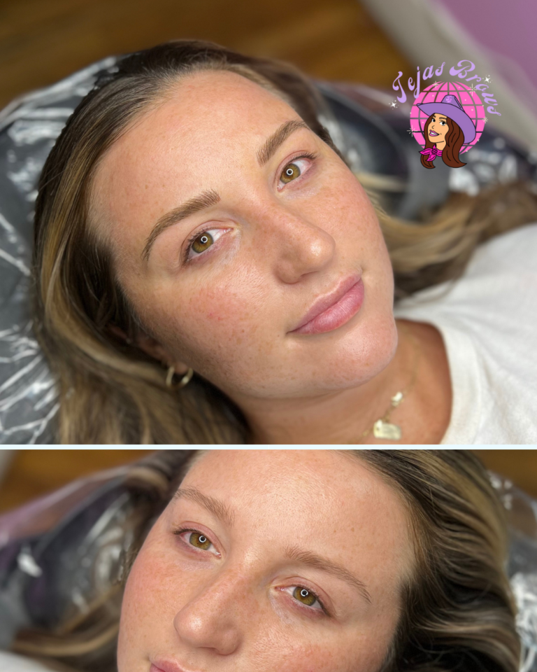 Before After CA copy 768x960